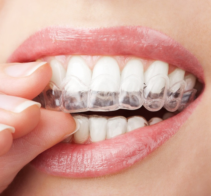 orthodontic