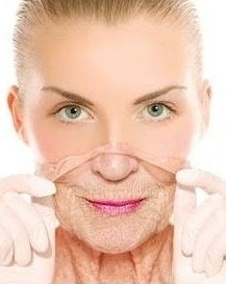 Anti Wrinkle Injections 2